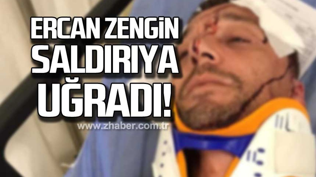Ercan Zengin saldırıya uğradı!