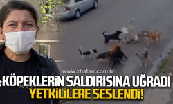Köpeklerin saldırısına uğradı yetkililere seslendi!