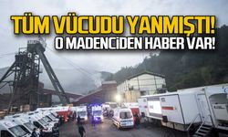 Grizuda tüm vücudu yanmıştı! Madenci Erol Bulduk'tan haber var!