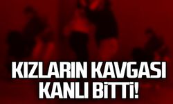 Zonguldak'ta kızların kavgası kanlı bitti: 1 yaralı