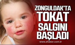 Zonguldak'ta çocuklarda "Tokatlanmış Yanak Sendromu" salgını!