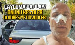 Çaycuma'da olay! Önünü kestiler öldüresiye dövdüler!