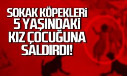 Kdz. Ereğli'de sokak köpekleri 5 yaşındaki kız çocuğuna saldırdı!