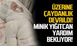 Üzerine çaydanlık devrildi! Minik Yiğitcan yardım bekliyor!