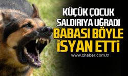 Devrek'te küçük çocuk saldırıya uğradı! Babası böyle isyan etti!