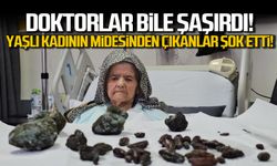 Doktorlar bile şaşırdı! Yaşlı kadının midesinden çıkanlar şok etti!