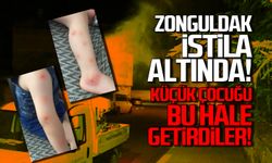Zonguldak istila altında! Küçük çocuğu bu hale getirdiler!
