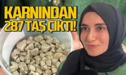 Karın ağrısıyla gitti 287 tane taş çıkarıldı: Doktorlar bile şok oldu!