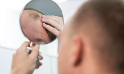 Sarımsaklı Şampuan Saç Dökülmesine Gerçekten İyi Gelir mi?