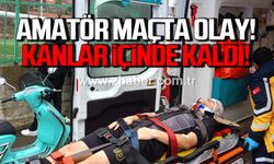 Amatör maçta olay... Kanlar içinde kaldı