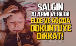 Salgın alarmı verildi. El ve ağızda döküntüye dikkat