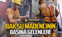 Bak şu madencinin başına gelenlere.