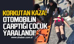 Alaplı'da otomobilin çarptığı çocuk yaralandı