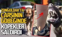 Zonguldak’ta çarşının göbeğinde köpek saldırısına uğradılar