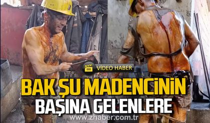 Bak şu madencinin başına gelenlere.