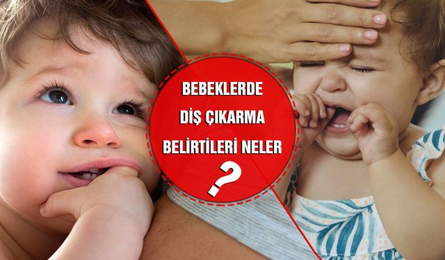 Çocuklarda / Bebeklerde Diş Çıkarma Dönemi Belirtileri