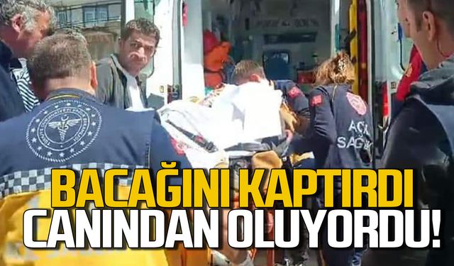 Bacağını patpata kaptırdı! Canından oluyordu!