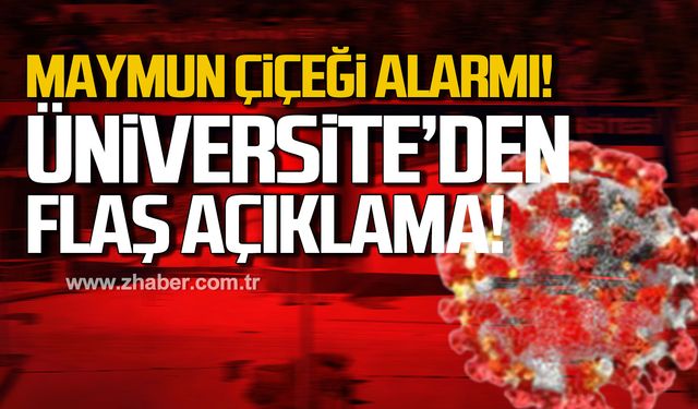 Maymun çiçeği alarmı! Karabük Üniversitesi'nden flaş açıklama!