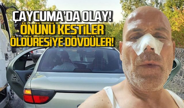 Çaycuma'da olay! Önünü kestiler öldüresiye dövdüler!