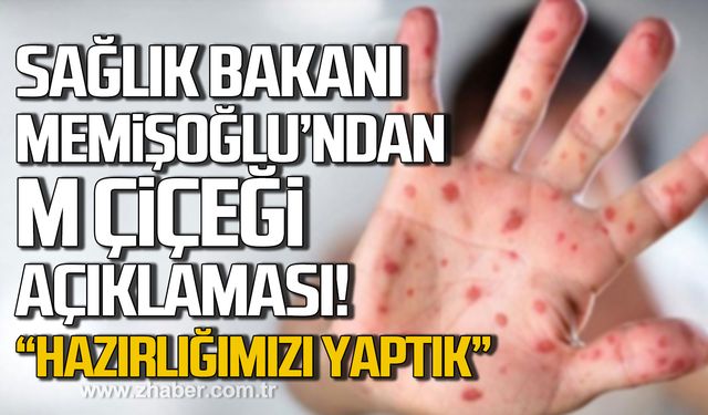 Sağlık Bakanı Kemal Memişoğlu'ndan M çiçeği açıklaması! "Sağlık sistemi olarak buna hazırız"