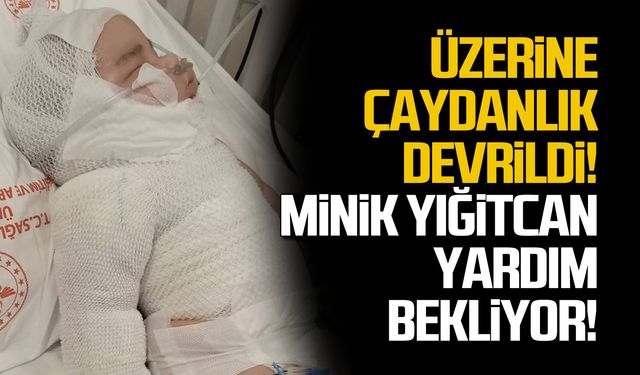 Üzerine çaydanlık devrildi! Minik Yiğitcan yardım bekliyor!