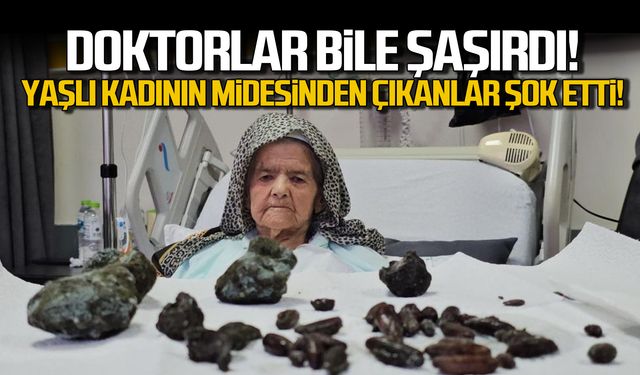 Doktorlar bile şaşırdı! Yaşlı kadının midesinden çıkanlar şok etti!