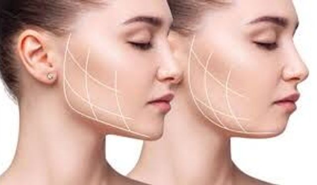 Yüz Estetiği ve Çene Sağlığı Arasında Masseter Botoks Uygulaması