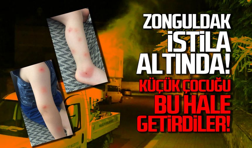 Zonguldak istila altında! Küçük çocuğu bu hale getirdiler!
