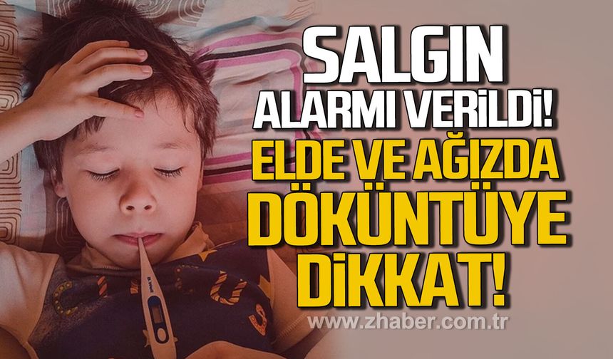 Salgın alarmı verildi. El ve ağızda döküntüye dikkat
