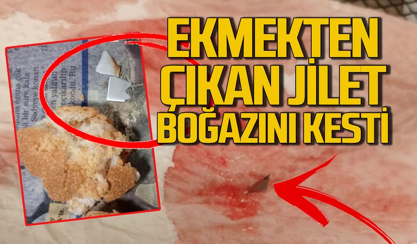 Ekmeğin içinden çıkan jilet vatandaşın boğazını kesti