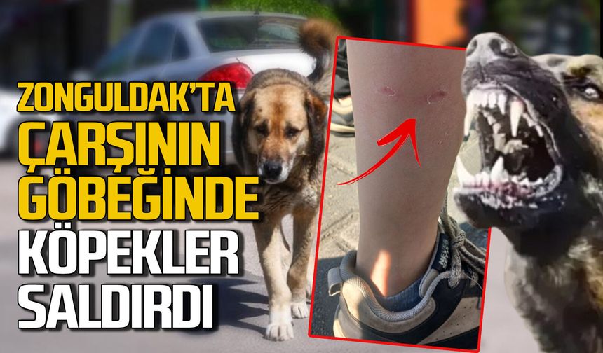 Zonguldak’ta çarşının göbeğinde köpek saldırısına uğradılar