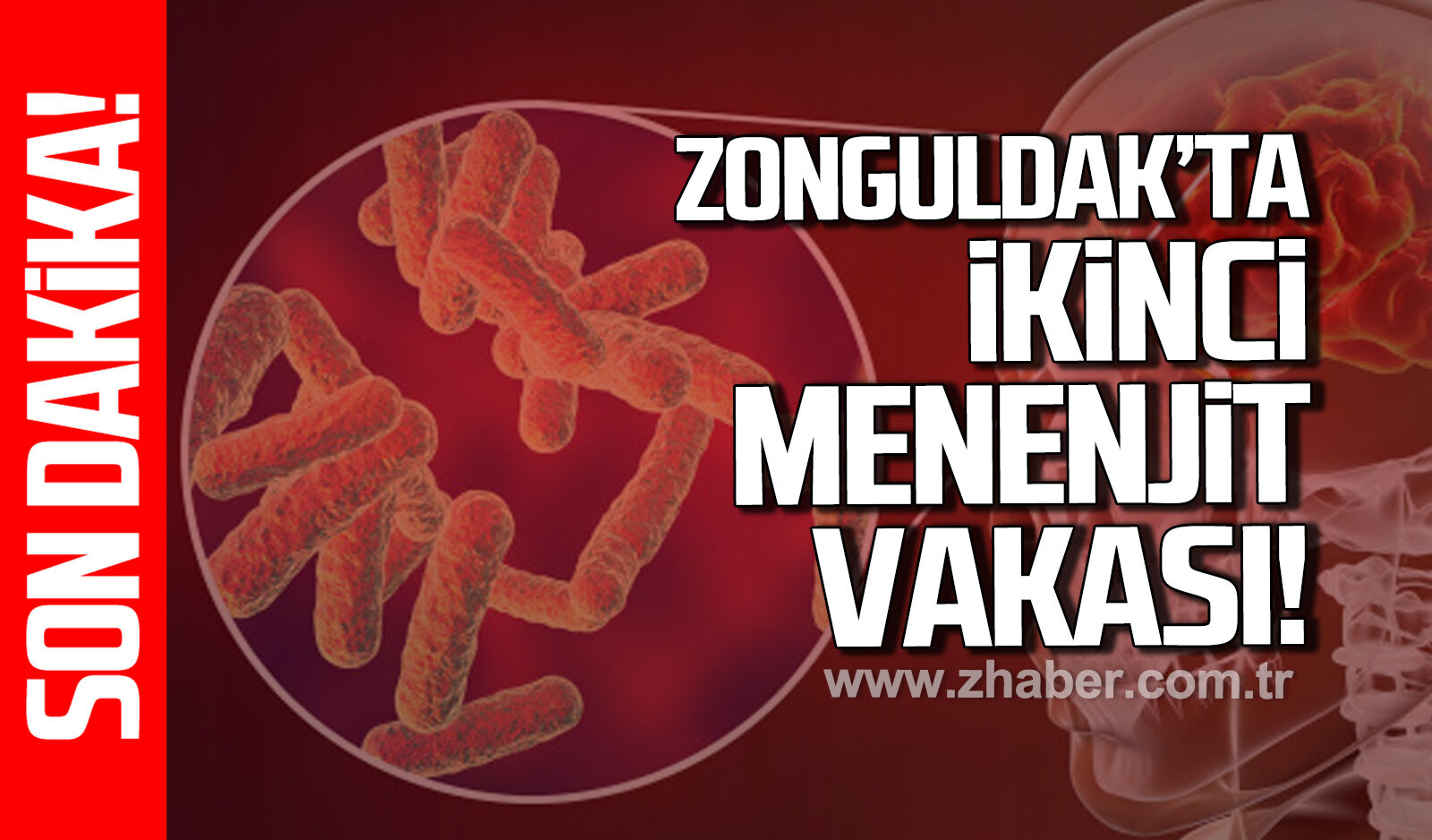 Zonguldak’ta ikinci menenjit vakası